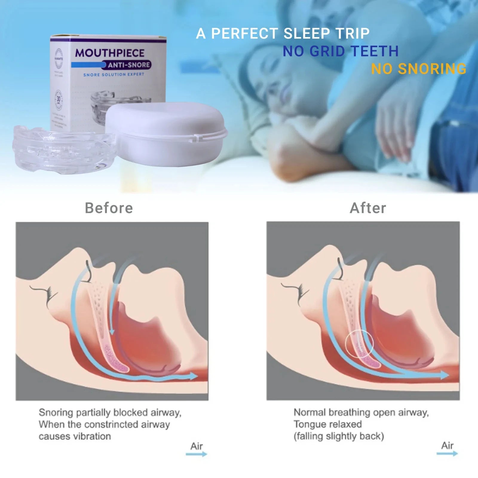 Mouldable mouth guard for snoring relief